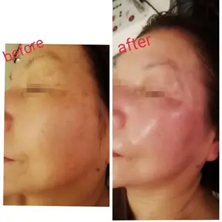 ECLAT所属・プライベートサロン✢ Eclatエクラ　のエステ・リラクイメージ