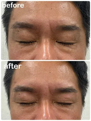 メンズ アイブロウ Mubye所属・Yamagtchi hinaのエステ・リラクイメージ