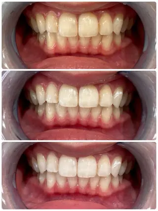 エクシアホワイト日本橋店所属・エクシアホワイト 日本橋／志村のその他イメージ