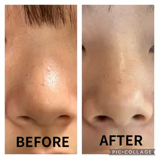 小滝 悠妃のネイルデザイン