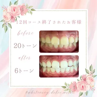 セルフホワイトニング Dolce八王子店のその他イメージ