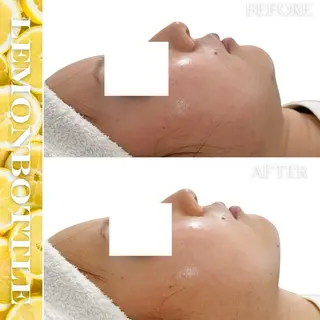 Liam《美肌管理/ 3D小顔/脂肪ケア》のエステ・リラクイメージ