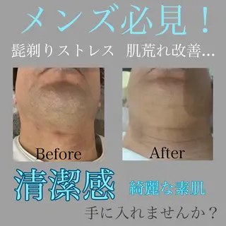 メンズ 25salon所属・25salon MIHOのエステ・リラクイメージ