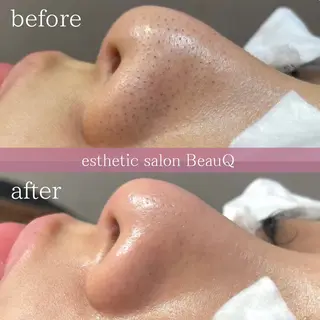 肌質改善/ブライダル 水上百華のエステ・リラクイメージ