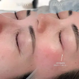 enam.所属・enam.梅田 / 肌育ハーブピーリングのエステ・リラクイメージ