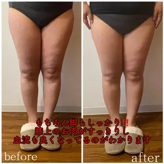 LILY REBBONのエステ・リラクイメージ