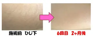 Salon Ree Belle(サロン リベル)所属・サロン リベル YUKAのエステ・リラクイメージ