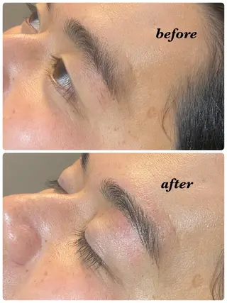 アイブロウ ハーブピーリング/韓国肌管理/フェイシャル/毛穴洗浄/眉毛/顔脱毛【糸脱毛専門】rev所属・ハーブピーリング🌹 毛穴洗浄❤️眉waxのエステ・リラクイメージ