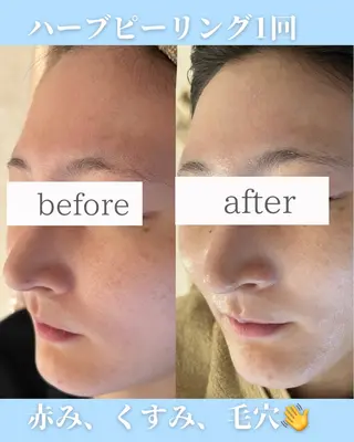 小嶋萌 今池駅徒歩2分のエステ・リラクイメージ