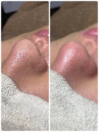 メンズ メンズガーデン今池店所属・メンズガーデン 今池の眉毛・アイブロウイメージ