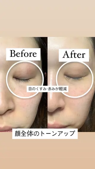 デ・アイム新潟　　北所属・山口 萌のエステ・リラクイメージ