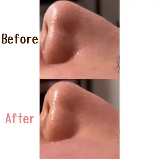 ゆか/エステサロン Lilasmileのエステ・リラクイメージ