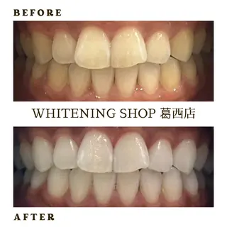 メンズ ホワイトニング ショップ葛西店のその他イメージ