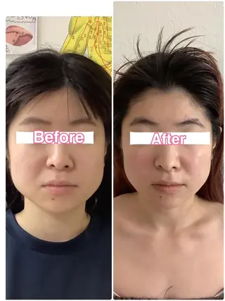 美容鍼・整体サロン アネモネ🌸心斎橋のエステ・リラクイメージ