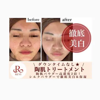 Horishia 福岡博多店のエステ・リラクイメージ