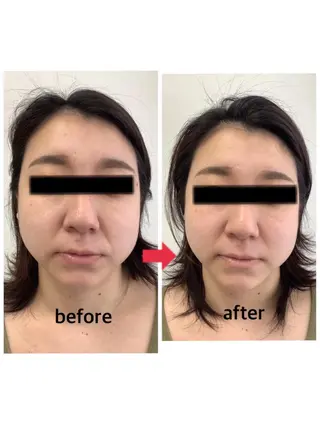 メディカルサロンドオフ所属・ハリサロンドオフ 美容鍼灸×小顔整体のエステ・リラクイメージ