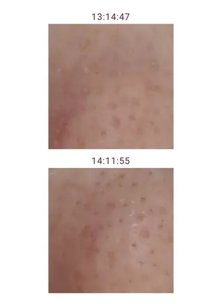 メナードフェイシャルサロン　リンガーデン所属・山口 郁代のエステ・リラクイメージ