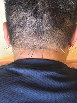 かすがい鍼灸院Re.heart所属・かすがい鍼灸院 Re.heartのエステ・リラクイメージ