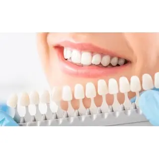 セルフホワイトニング エクシア大曽根店のその他イメージ