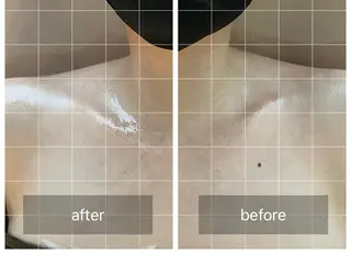 心斎橋痩身ダイエット 韓国.美容鍼.小顔のエステ・リラクイメージ