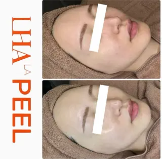 ハーブピーリング専門 BIOPLUS＋川崎のエステ・リラクイメージ