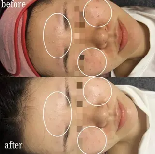 看護師が施術する美容 ナスサロ/城野のエステ・リラクイメージ