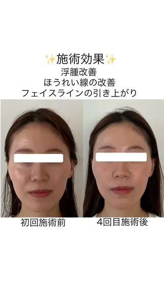 美容小顔・整体 ・美容鍼　SAKUのエステ・リラクイメージ