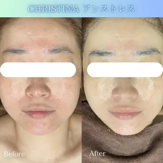 DahliaBeauty ダリアビューティー所属・Dahlia痩身脱毛 フェイシャル 中村のエステ・リラクイメージ