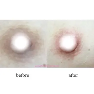 小顔専門看護師クリニカルサロンCOCO所属・小顔と美肌サロン クリニカルサロンココのエステ・リラクイメージ