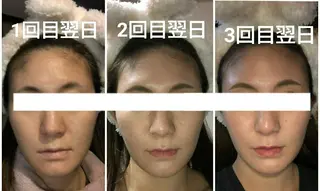 小顔と美肌 まごころエステMatoria所属・小顔 美肌専門 Matoriaのエステ・リラクイメージ