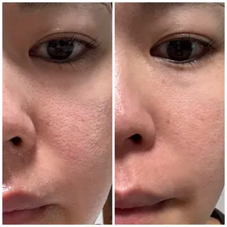 サロンur（ユア） Rieのエステ・リラクイメージ