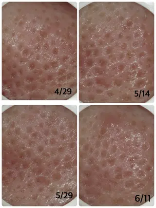 メナード片町 やまもと みくのエステ・リラクイメージ