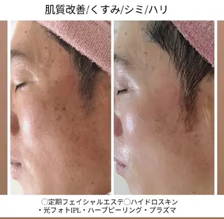 ユニセックスエステサロンUniclear所属・痩身&フェイシャル Uniclearのエステ・リラクイメージ