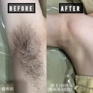 メンズ b-free メンズサロンのエステ・リラクイメージ