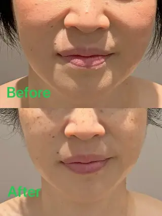 Hair&Spa リーノ所属・折原 あやのエステ・リラクイメージ