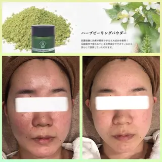 エステサロン JURISのエステ・リラクイメージ