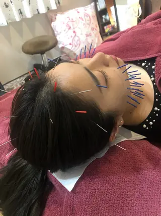 美容鍼灸女性専用 りんご鍼灸治療院のエステ・リラクイメージ