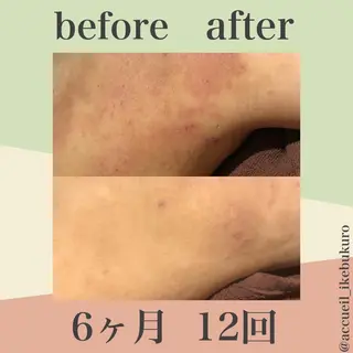 ミディアム カラー パーマ ヘアアレンジ メンズ キッズ ネイル マツエク・マツパ ニキビ・肌質改善専門 ♡人生が変わるサロンのエステ・リラクイメージ