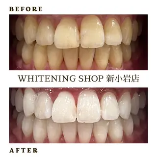 メンズ ホワイトニング ショップ新小岩店のその他イメージ