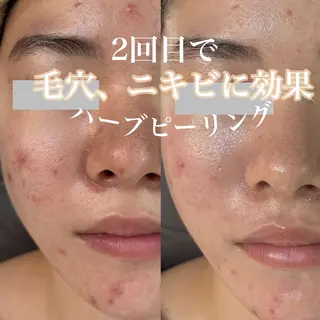 WHITE AQUA 北千住店のエステ・リラクイメージ