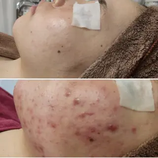 Anacia Beauty Salon所属・美肌脱毛&毛穴専門 Anaciaのエステ・リラクイメージ