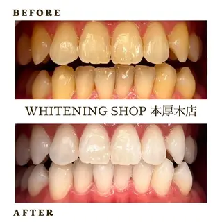 メンズ ホワイトニング ショップ本厚木のその他イメージ
