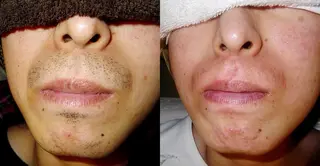 YES脱毛サロン　大阪京橋店所属・メンズ脱毛サロン YESのエステ・リラクイメージ