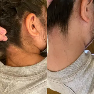 スターラッシュ薬院本店所属・スターラッシュ staffのエステ・リラクイメージ