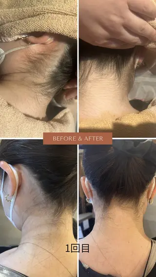 エステサロン TRINTEのエステ・リラクイメージ