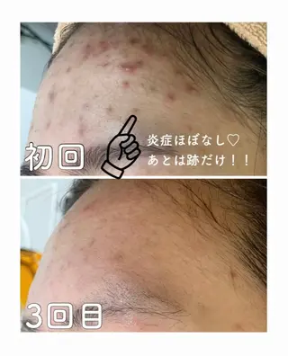 都度払い肌改善専門店 店長二上文香のエステ・リラクイメージ