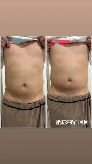 アルカンジュ~archange~所属・痩身/毛穴洗浄/脱毛 アルカンジュのエステ・リラクイメージ