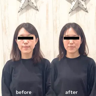 目黒/小顔/整体/ 理学療法士/萩谷太陽のエステ・リラクイメージ