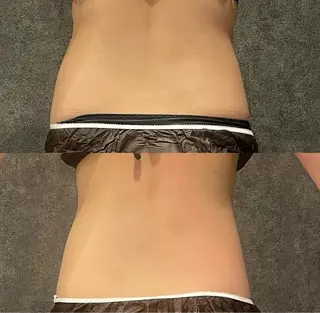 Re:Belle所属・Re:Belle 久留米 : 中島のエステ・リラクイメージ