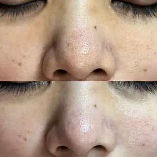 毛穴ケア・ヘッドスパサロンSHINY(シャイニー)所属・毛穴ケア・ヘッドスパ サロンSHINYのエステ・リラクイメージ